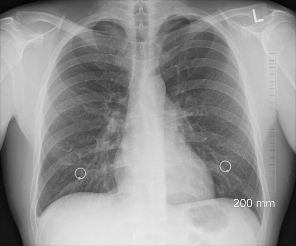 Como cuidar tus pulmones siendo un adulto mayor