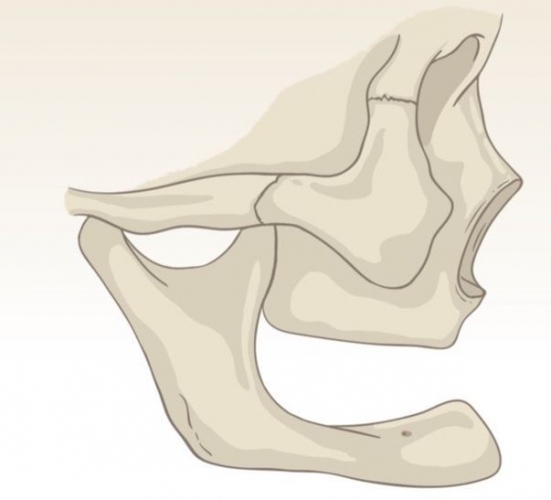 Innovación tecnológica y enfoque multidisciplinar para tratar la atrofia severa de hueso maxilar y mandibular