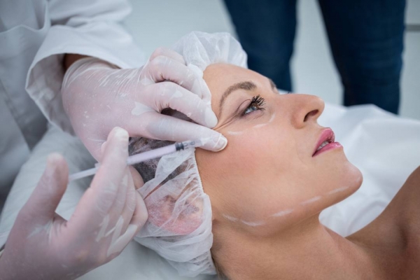 Relleno Facial Radiesse: todo lo que debes saber