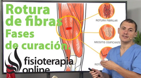 Fisioterapia en el desgarro muscular, qué es y cuales son sus causas y tratamiento